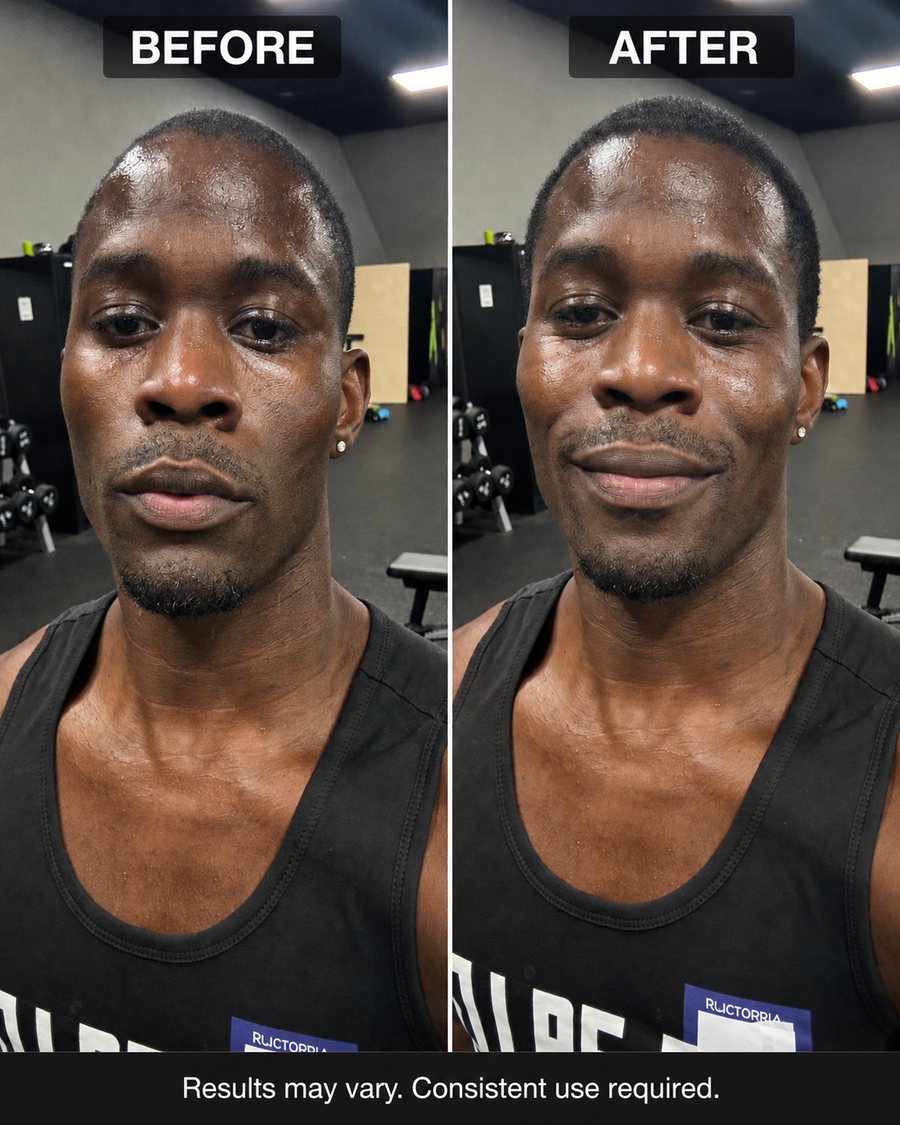"Train 5 days a week and my hairline was receding fast — thought it was just genetics. Started using this consistently and the growth came back. Still can't fully believe it but the photos don't lie."— Tebogo K., Pretoria ★★★★★
